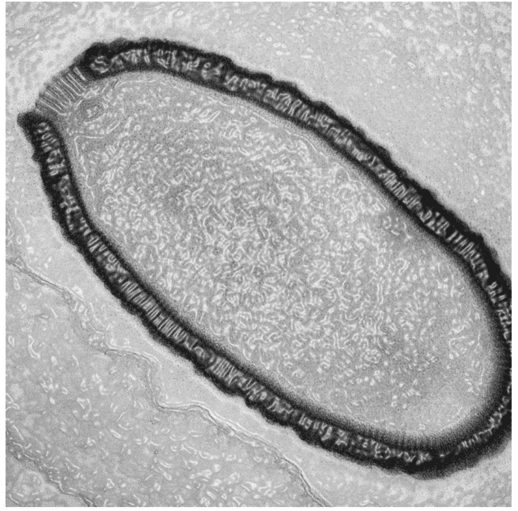 virus purba di lapisan es siberia